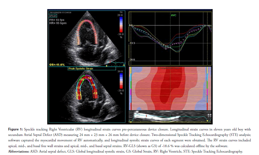 Global longitudinal strain by speckle tracking echocardiography