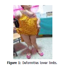 clinical-rheumatology-Deformities