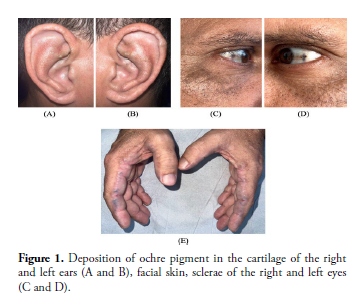 clinical-rheumatology-Deposition