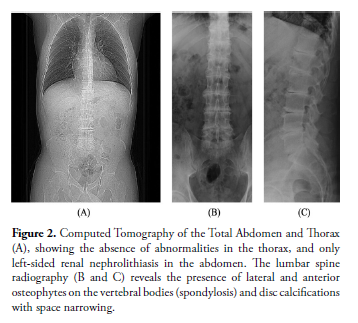 clinical-rheumatology-Tomography