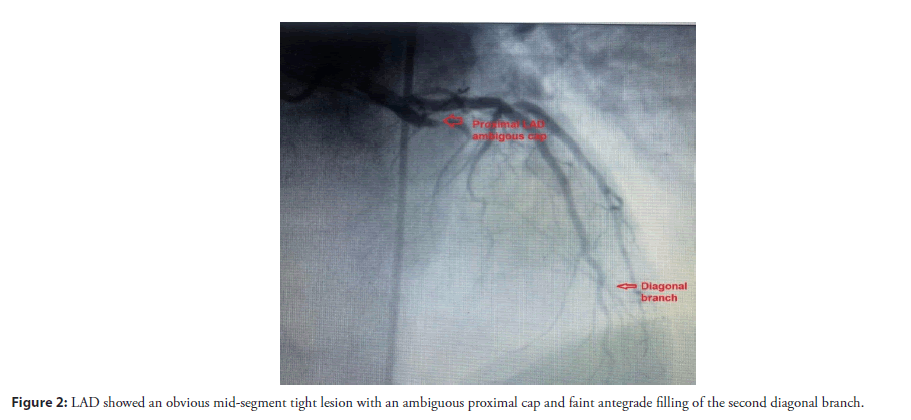 interventional-cardiolog-ambiguous