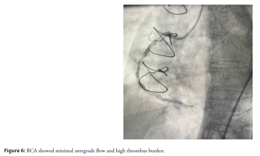 interventional-cardiolog-antegrade