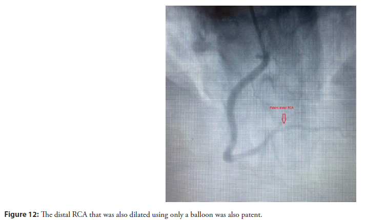 interventional-cardiolog-dilated