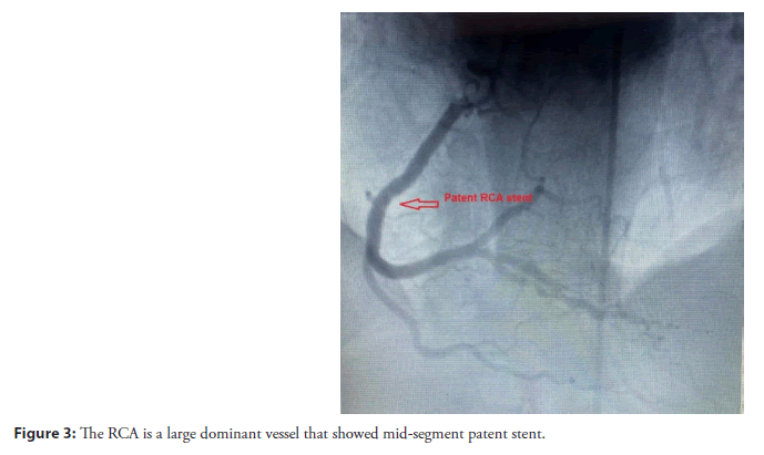 interventional-cardiolog-dominant