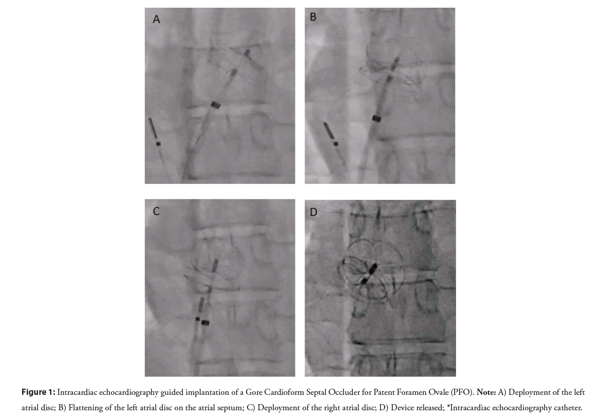 interventional-cardiolog-echocardiography