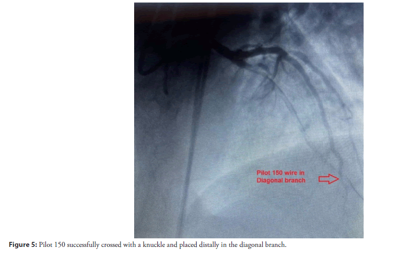 interventional-cardiolog-knuckle