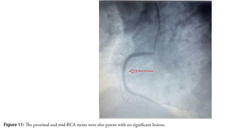 interventional-cardiolog-mid