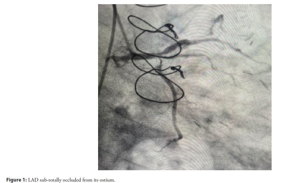 interventional-cardiolog-occluded