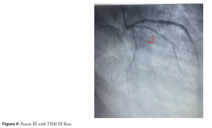 interventional-cardiolog-patent