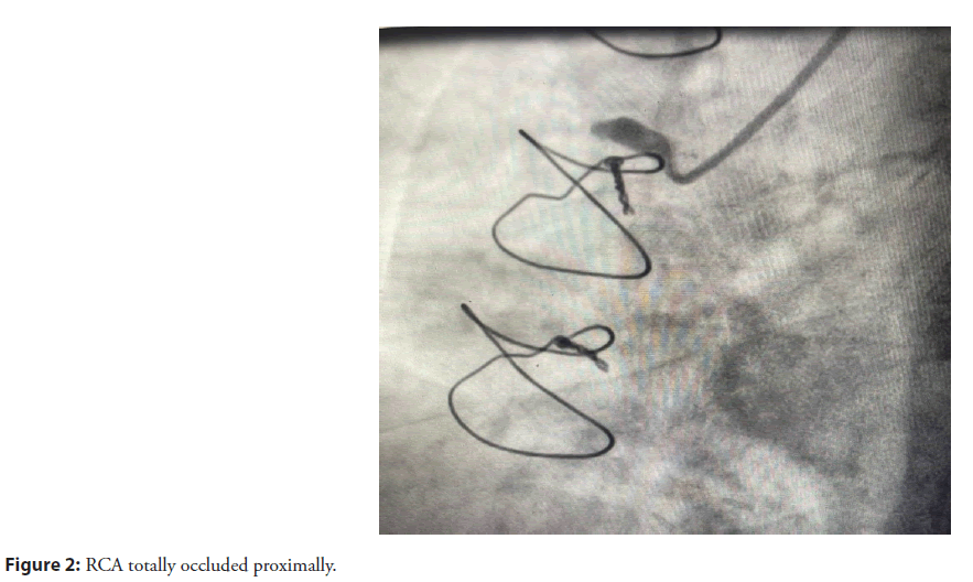 interventional-cardiolog-proximally