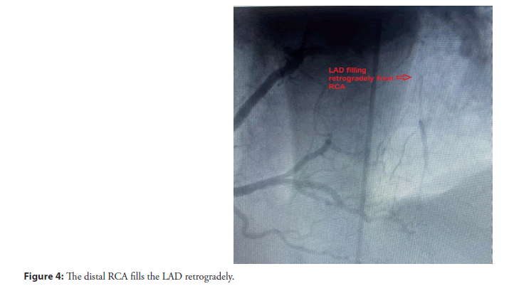 interventional-cardiolog-retrogradely