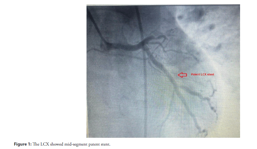 interventional-cardiolog-segment