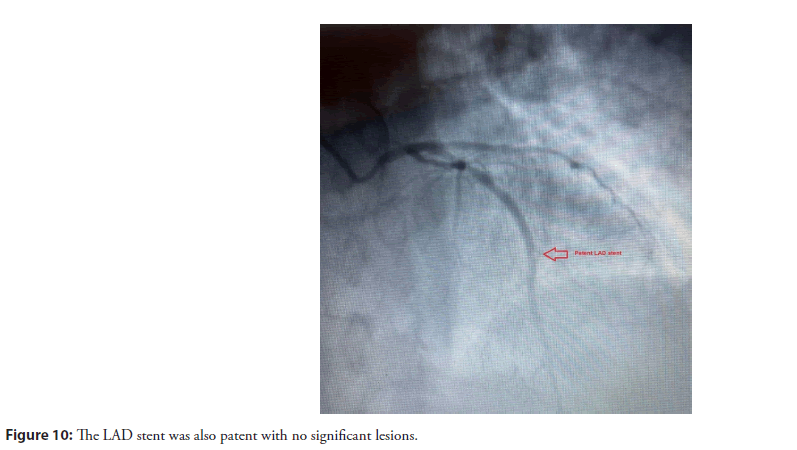 interventional-cardiolog-significant