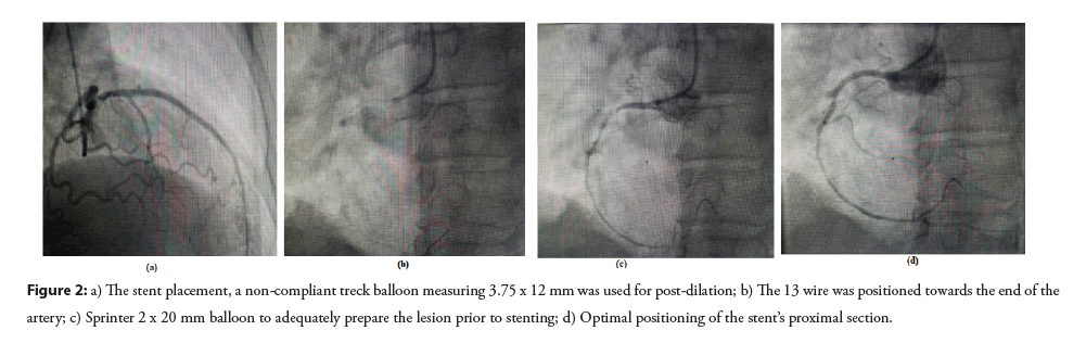 interventional-cardiolog-treck