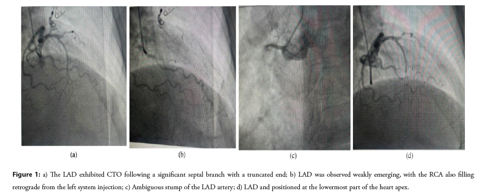 interventional-cardiolog-truncated