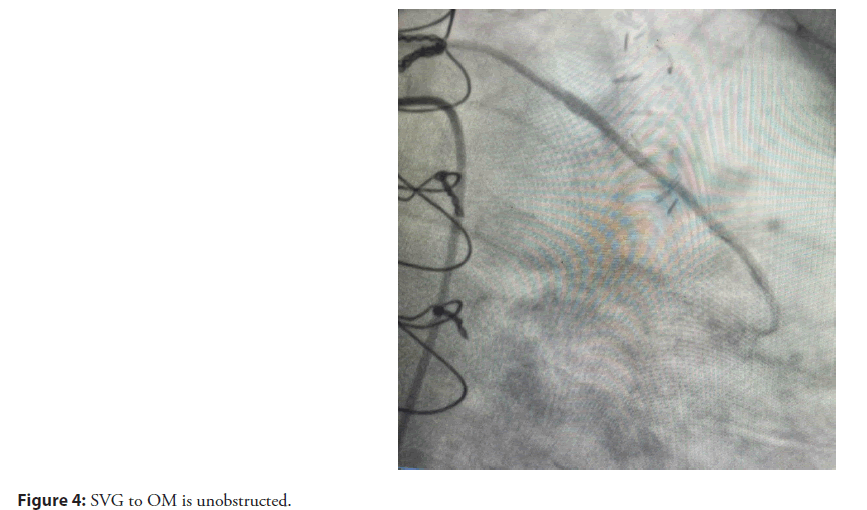 interventional-cardiolog-unobstructed