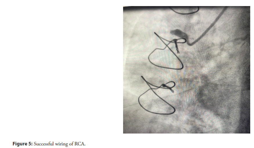 interventional-cardiolog-wiring