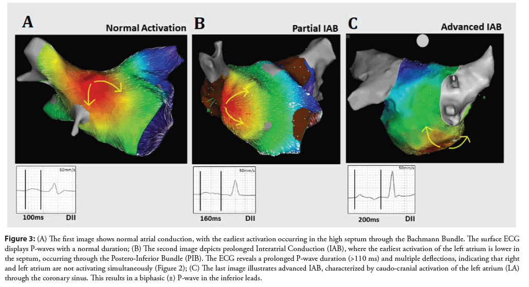 interventional-cardiology-earliest