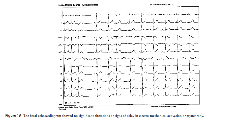 interventional-cardiology-echocardiogram