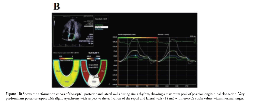 interventional-cardiology-posterior