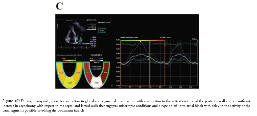 interventional-cardiology-reduction