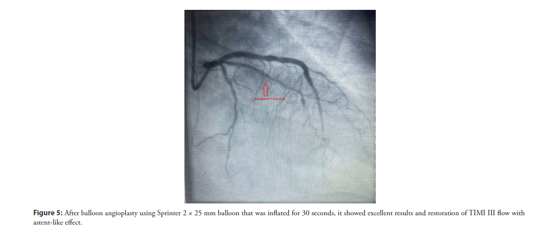 interventional-cardiology-restoration