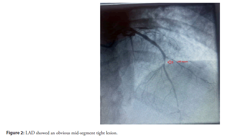 interventional-cardiology-segment