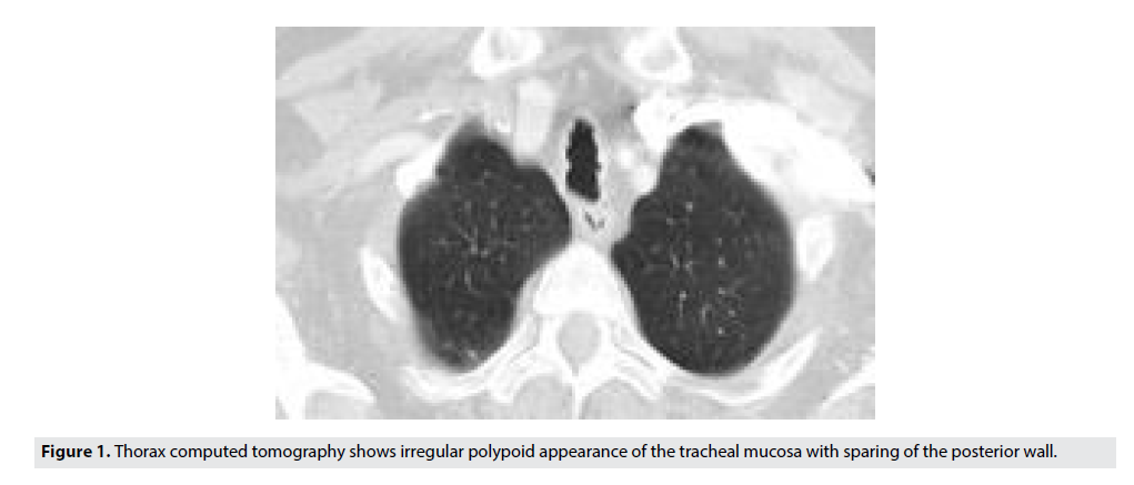 Imaging-Med-irregular-polypoid