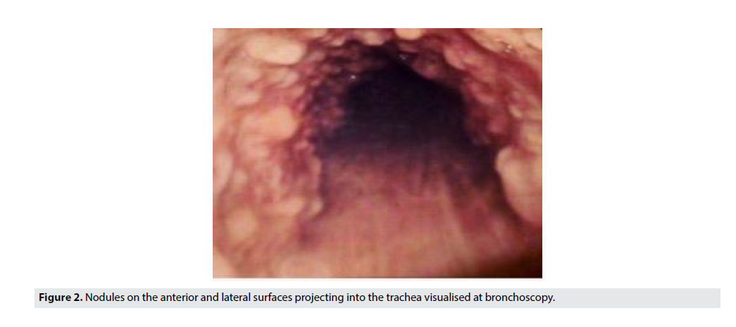 Imaging-Med-lateral-surfaces