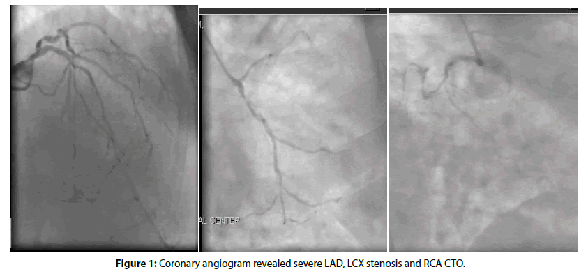 Interventional-Cardiology-angiogram