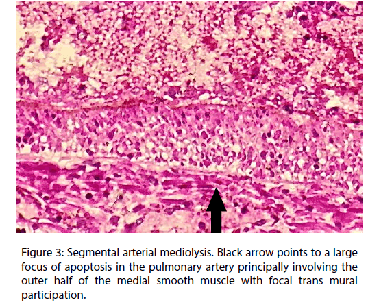 Interventional-Cardiology-arterial