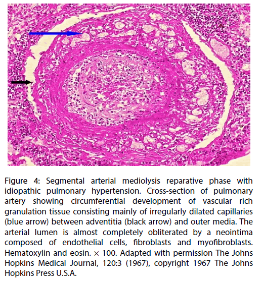 Interventional-Cardiology-circumferential