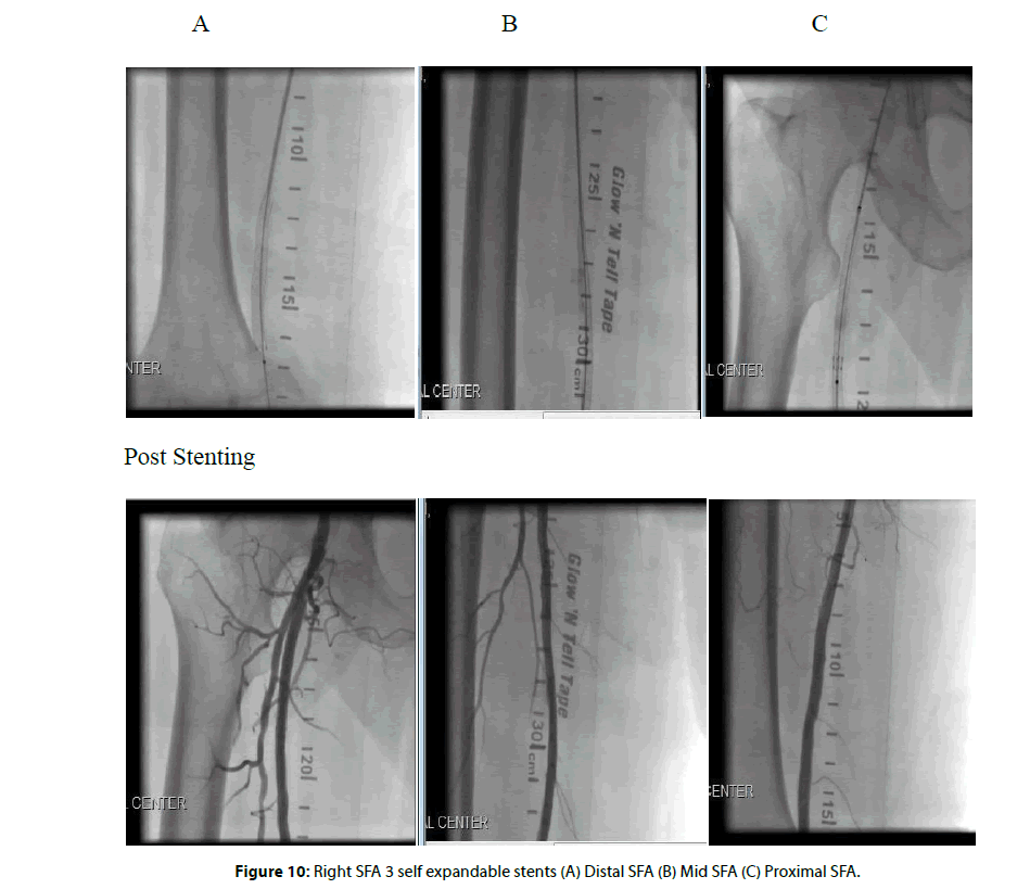 Interventional-Cardiology-expandable