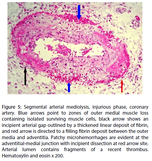 Interventional-Cardiology-injurious