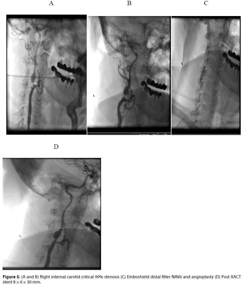 Interventional-Cardiology-prox-mid