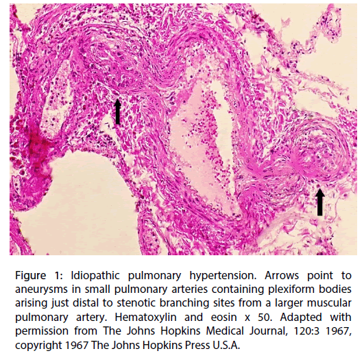 Interventional-Cardiology-pulmonary