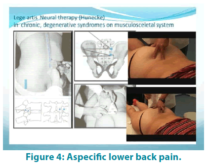 clinical-practice-Aspecific-lower