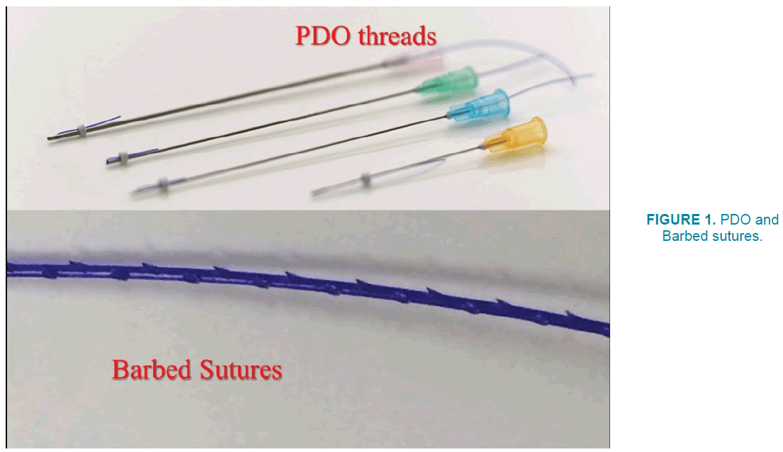 clinical-practice-Barbed-sutures