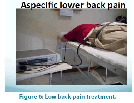 clinical-practice-Low-back-pain