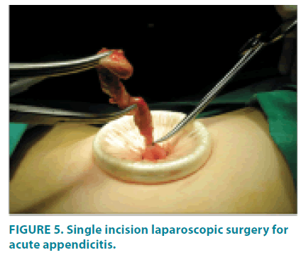 clinical-practice-acute-appendicitis