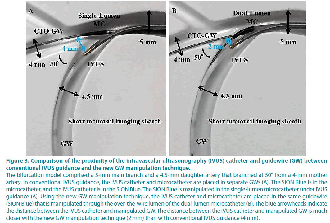 clinical-practice-intravascular-ultrasonography