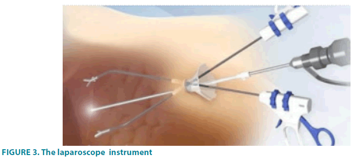 clinical-practice-laparoscope-instrument