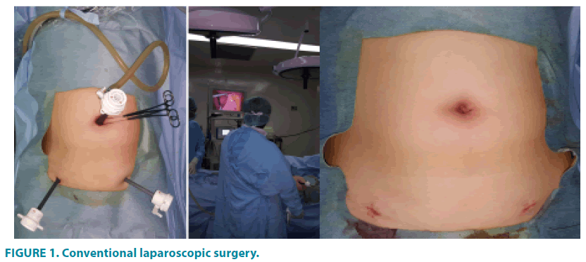clinical-practice-laparoscopic-surgery