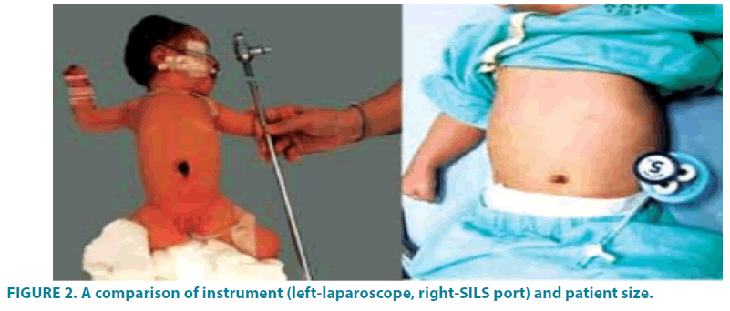 clinical-practice-left-laparoscope