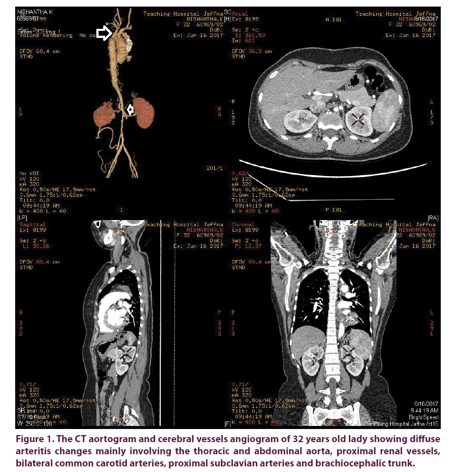 clinical-rheumatology-cerebral-vessels