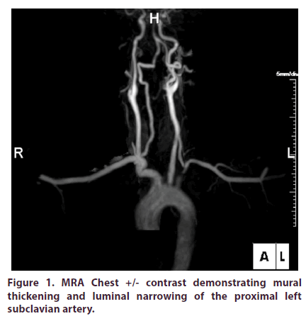 clinical-rheumatology-demonstrating