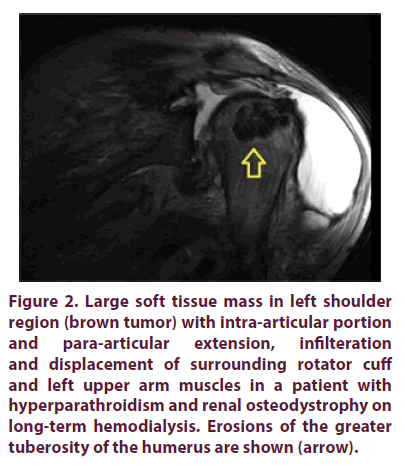 clinical-rheumatology-renal-osteodystrophy