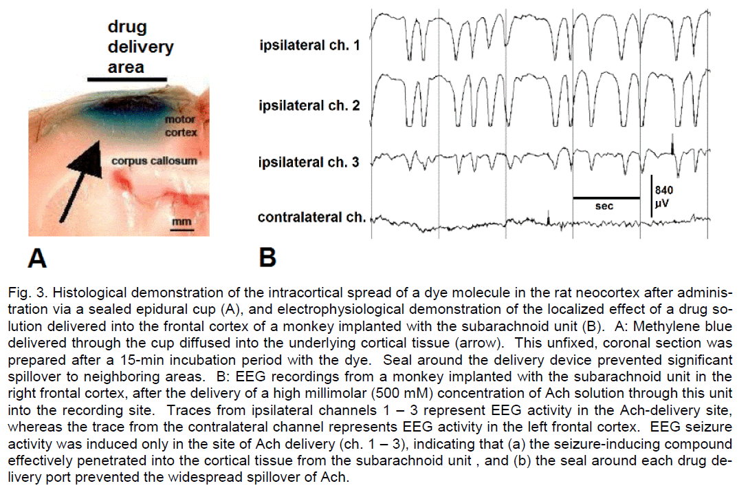 experimental-stroke-translational-medicine-Histological-demonstration