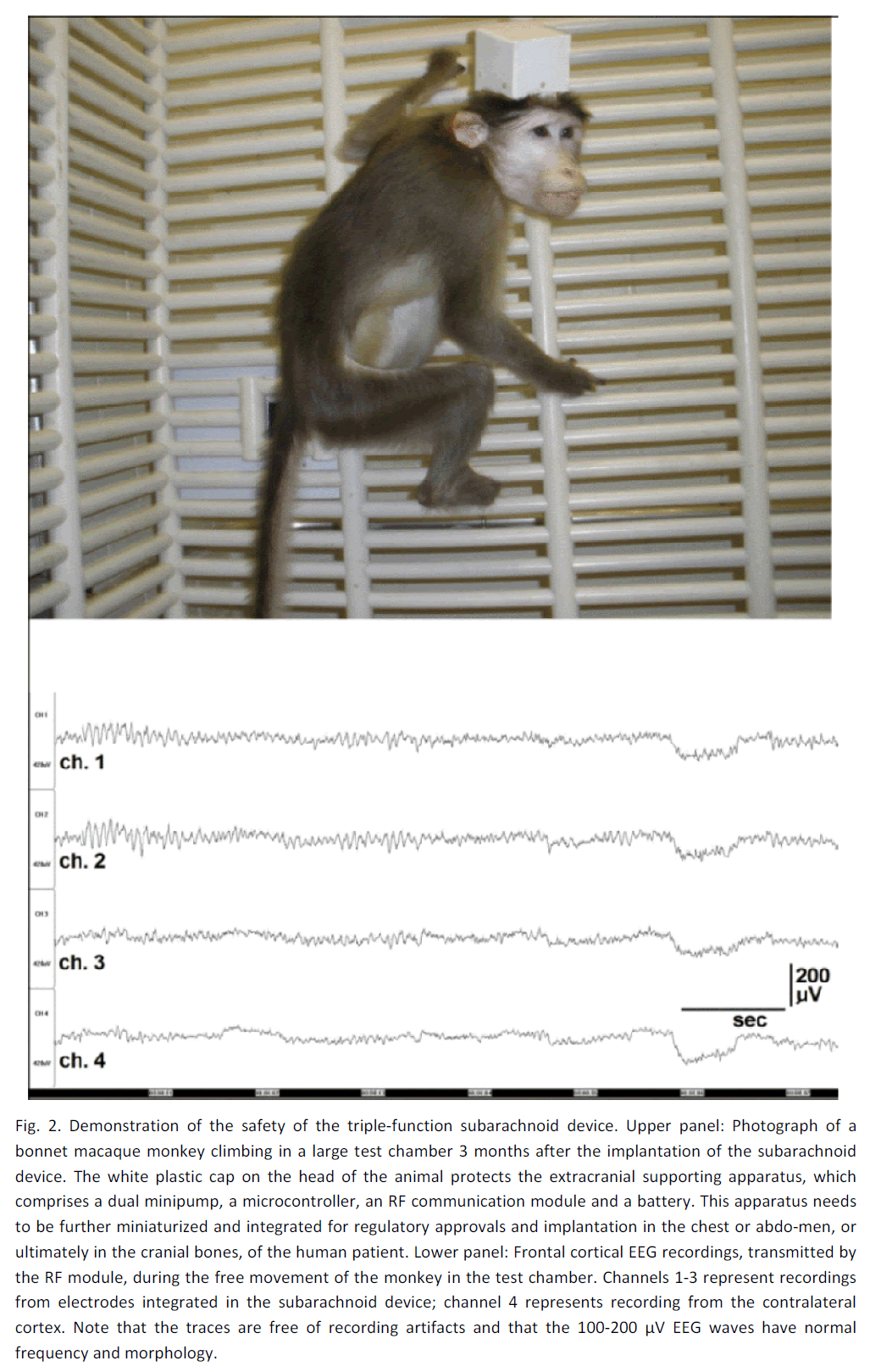 experimental-stroke-translational-medicine-triple-function