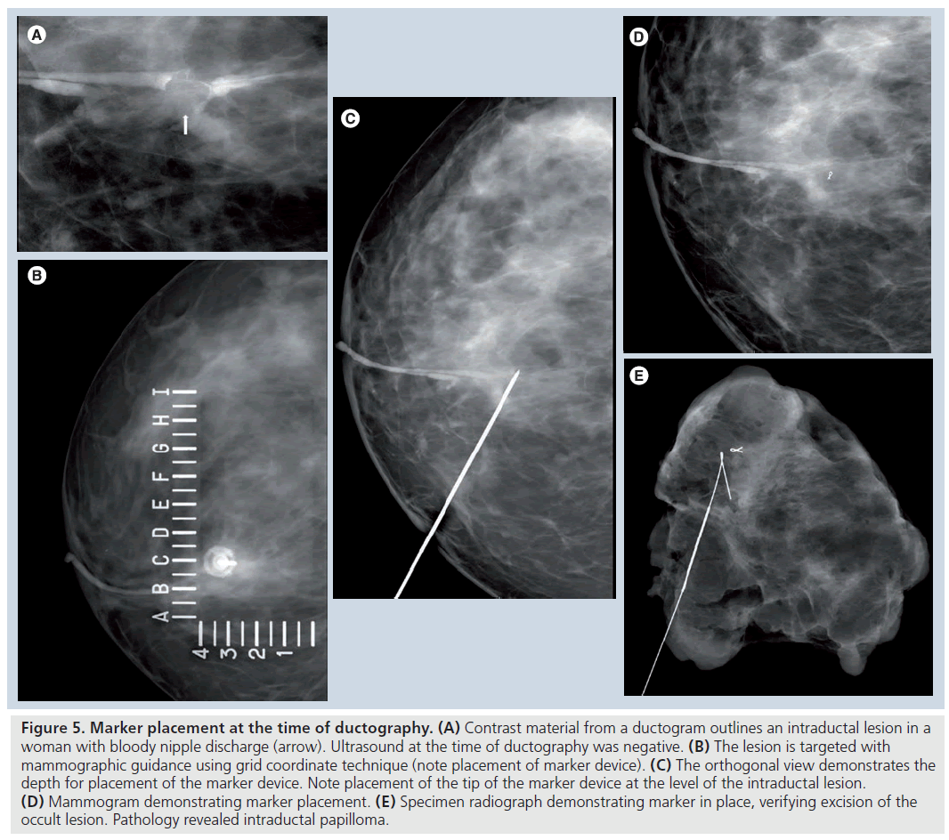 imaging-in-medicine-Contrast-material